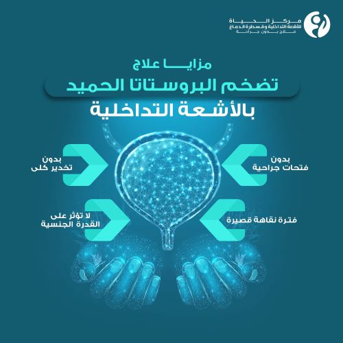 مميزات علاج تضخم البروستاتا بالأشعة التداخلية